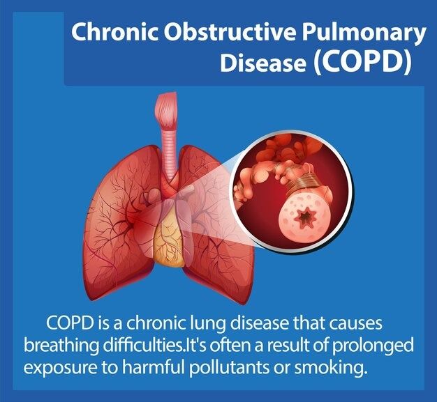 Chronic Obstructive Pulmonary Disease (COPD)