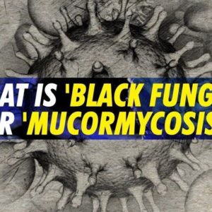 Black Fungus (Mucormycosis)