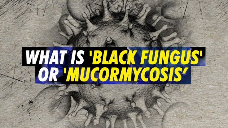 Black Fungus (Mucormycosis)