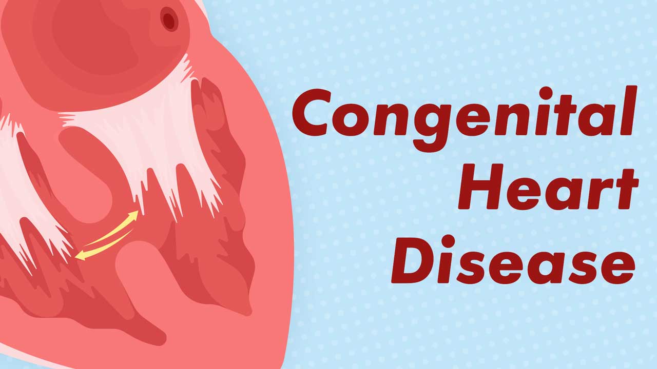 congenital heart disease