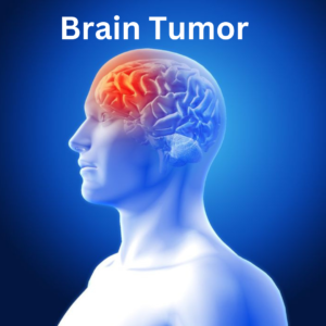 Brain Tumor