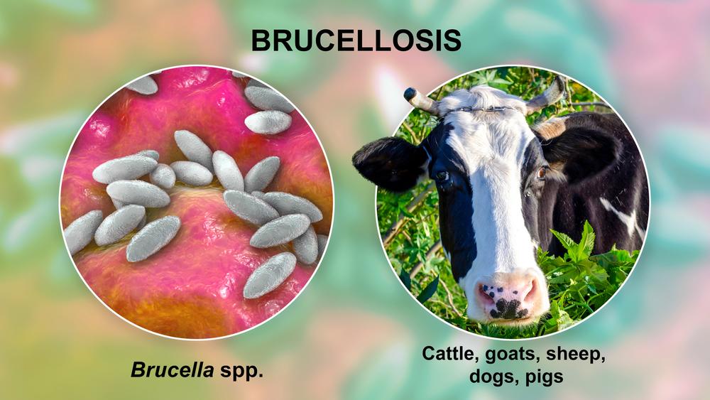 Brucellosis Disease