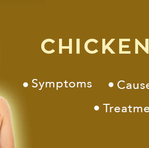 Chickenpox disease