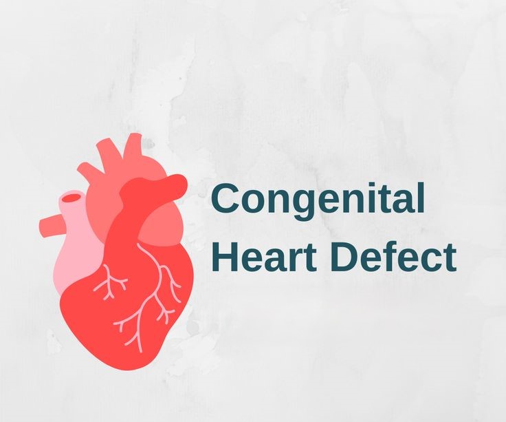 congenital heart disease